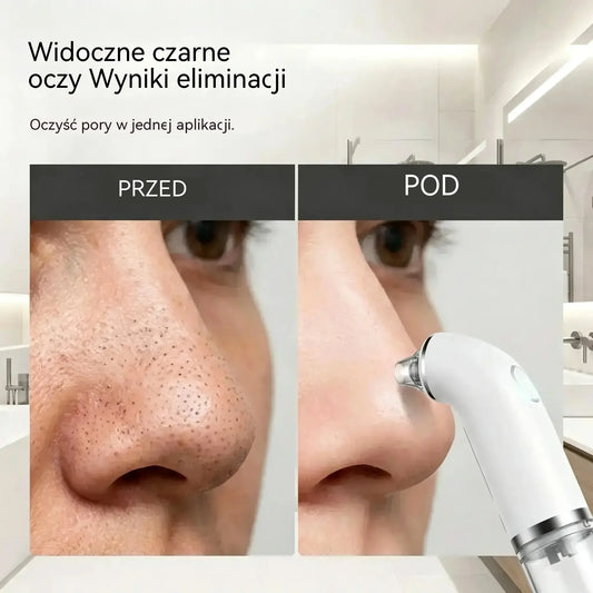 🔥 PROMOCJA! Elektryczny oczyszczacz do twarzy💆♀️Głębokie oczyszczanie porów · Efekt jędrniejszej i gładszej skóry ✨ Zadbaj o cerę w domu i oszczędź na salonie!