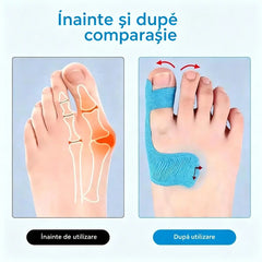 🌞🎉[50/100 bucăți] Apărători flexibile pentru degete, plasturi pentru arsuri, bandaje sportive durabile